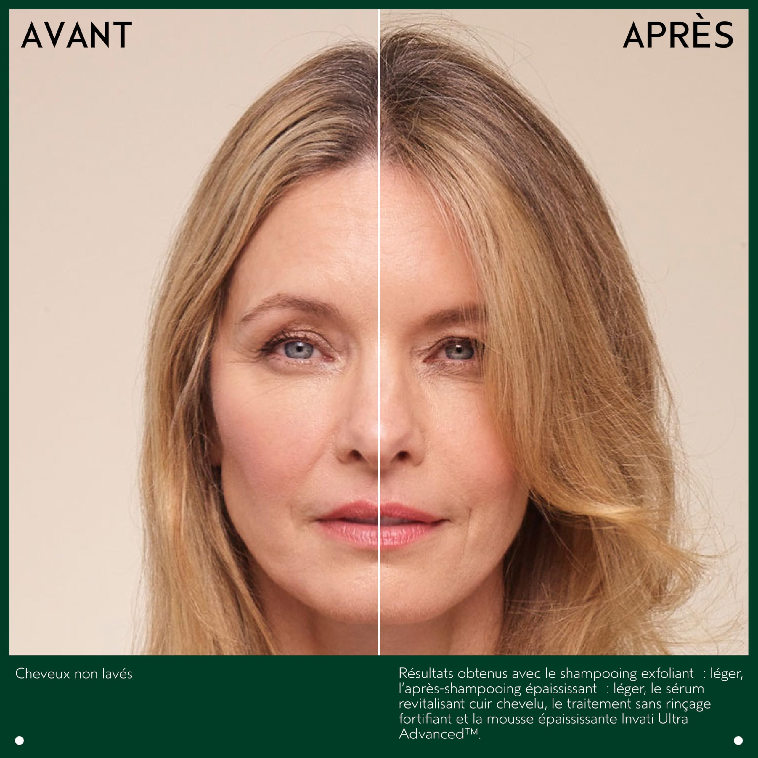 Amazon | インヴァティ ウルトラ アドバンス 4-STEPケアセット